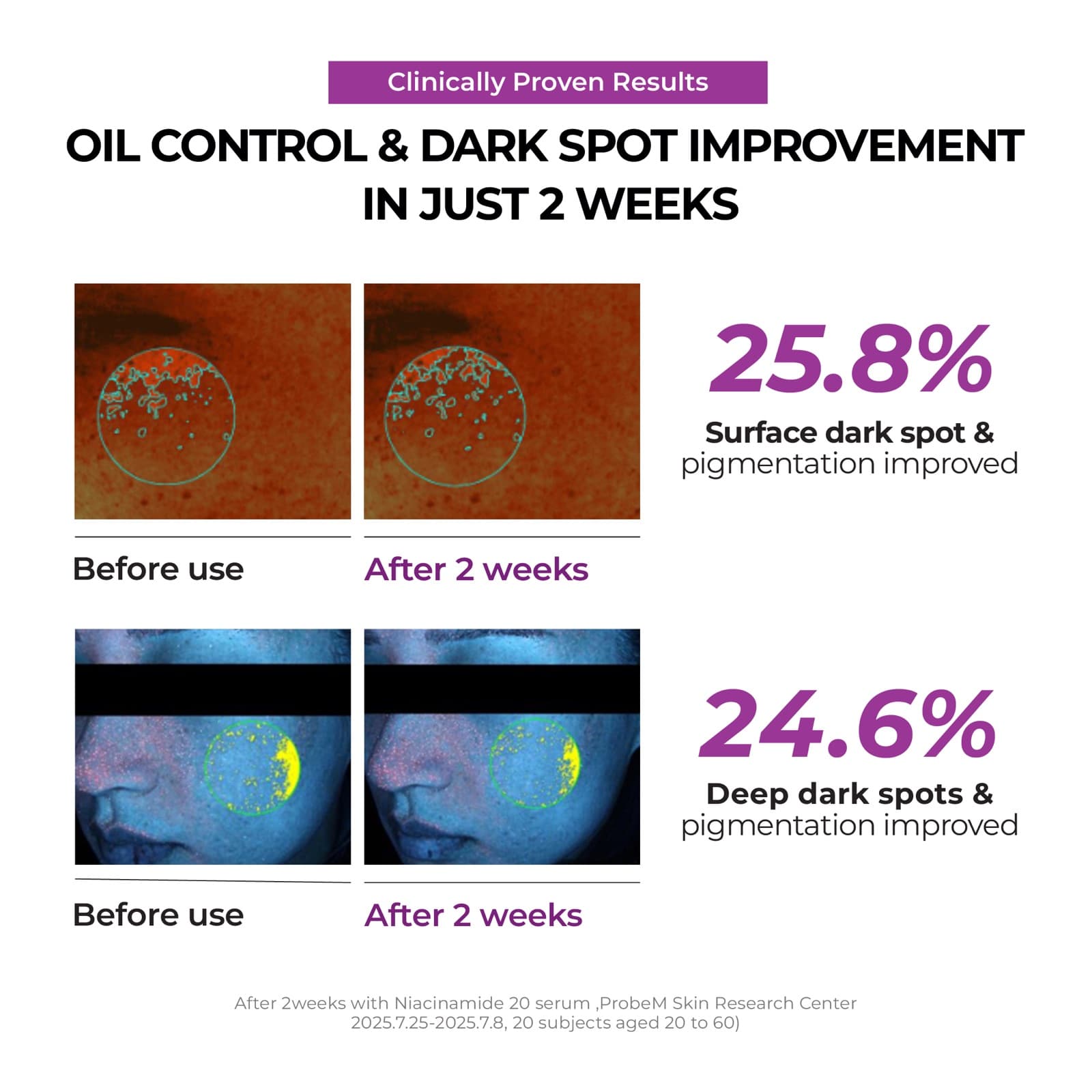 Niacianamide 2 + Oil Control Cream — detalle 4