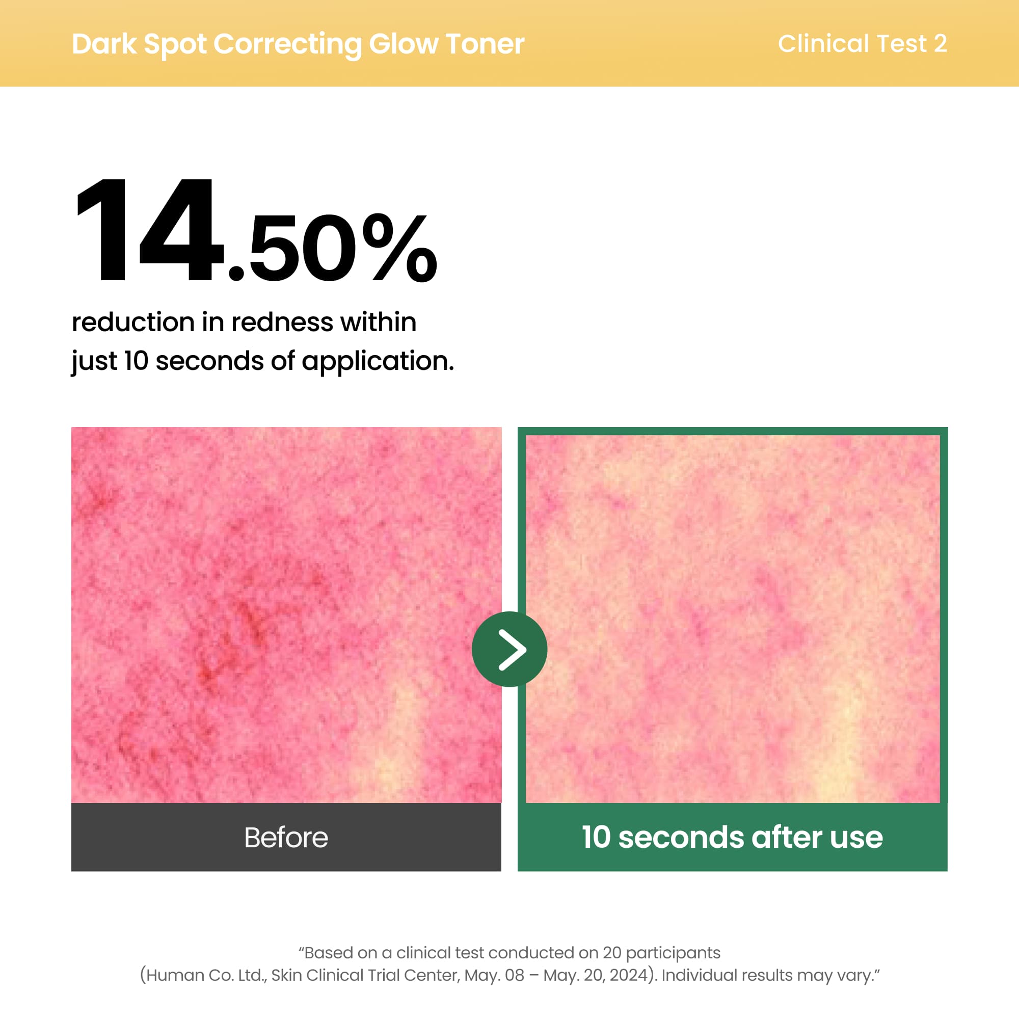 Dark Spot Correcting Glow Toner — detalle 5